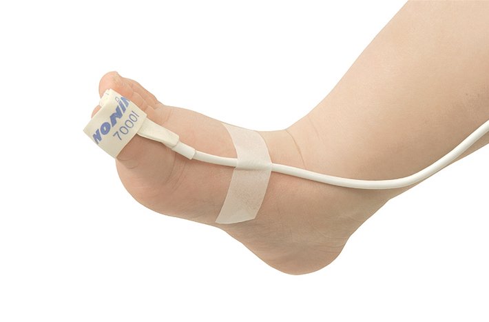 Nonin Infant Flexi-Form II™ Disposable Wrap Sensors  (1m Cable)