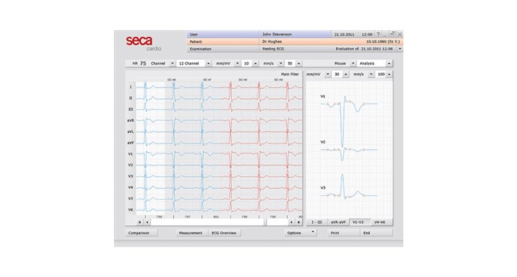 SECA CT321 Bluetooth Interpretive PC ECG (Discontinued)