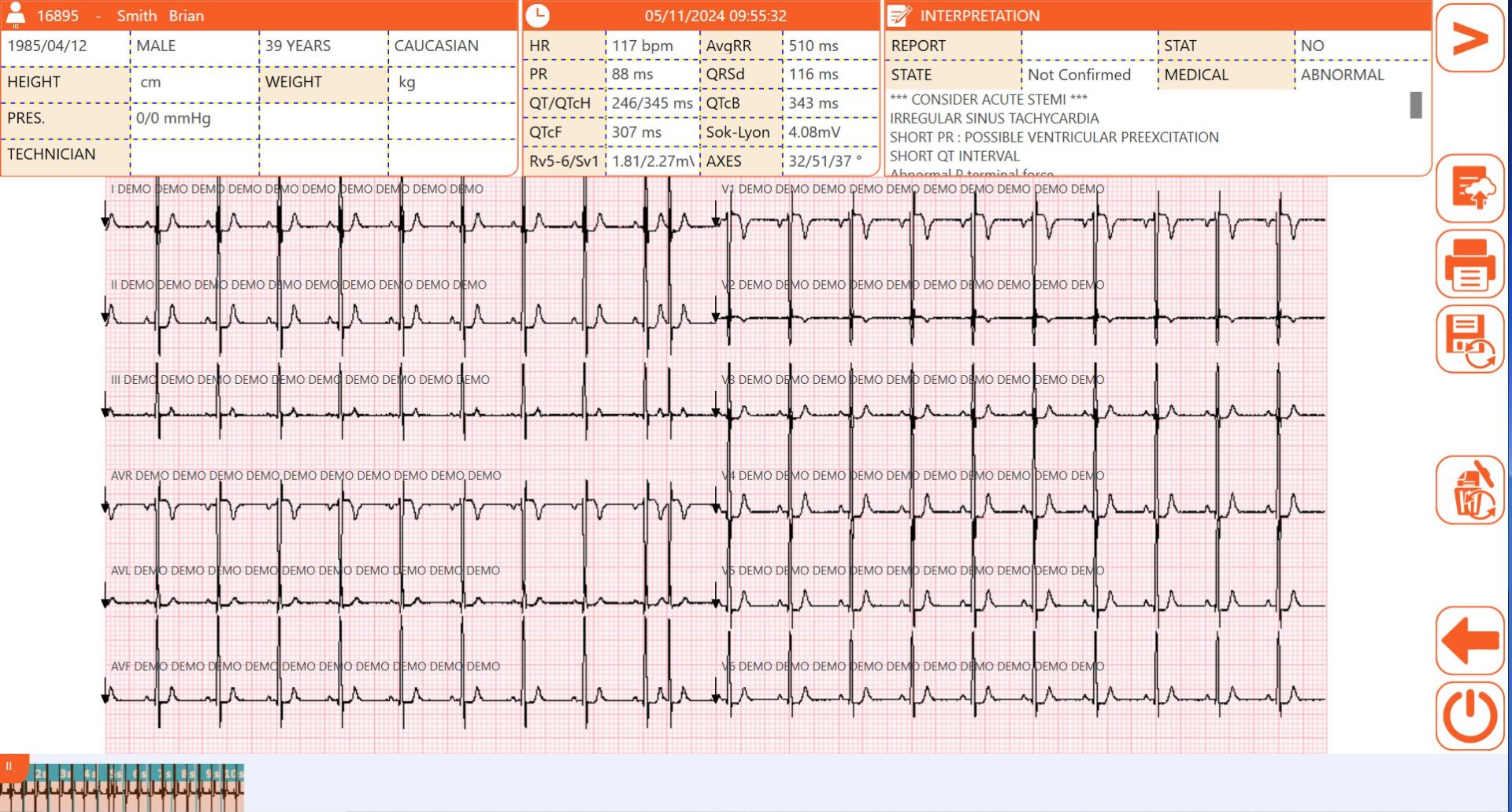 Cardioline touchECG - Windows 