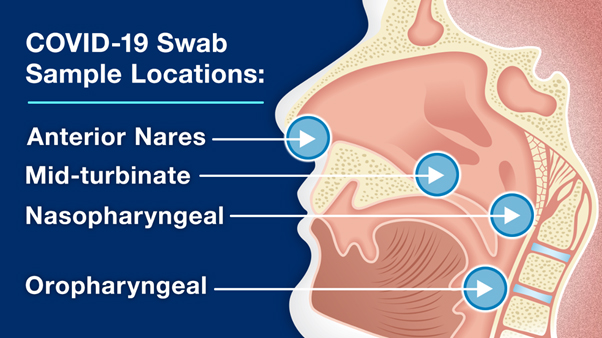 Swab Sample locations